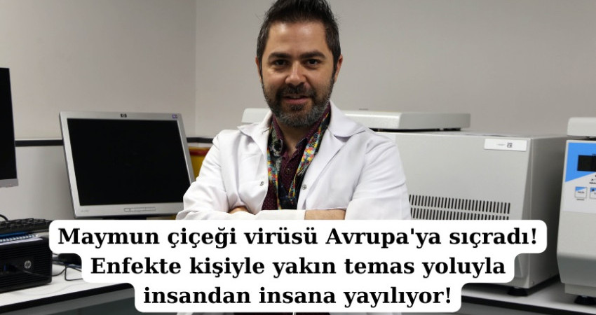 Maymun çiçeği virüsü Avrupa'ya sıçradı!